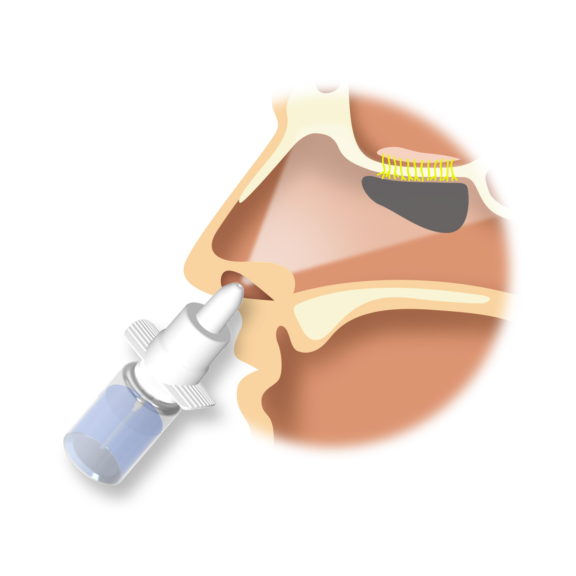 Diagram of nasal spray inserting into nasal opening providing drug delivery route to nose to brain pathway.